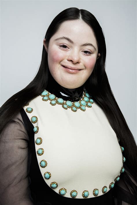 gucci down syndrome|down syndrome model gucci.